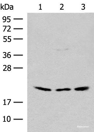 Western blot analysis of HEPG2 and Hela cell Mouse liver tissue lysates  using RPL23A Polyclonal Antibody at dilution of 1:300