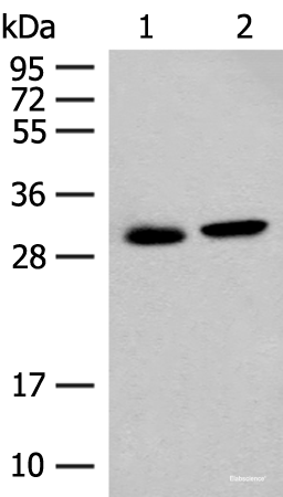 Western blot analysis of Mouse kidney tissue and Human kidney tissue lysates  using GLYAT Polyclonal Antibody at dilution of 1:300