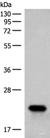Western blot analysis of Human fetal brain tissue lysate  using RAC3 Polyclonal Antibody at dilution of 1:400