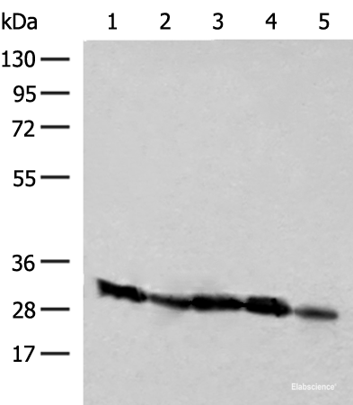 Western blot analysis of Raji Jurkat K562 and 231 cell Human kidney tissue lysates  using CD48 Polyclonal Antibody at dilution of 1:250