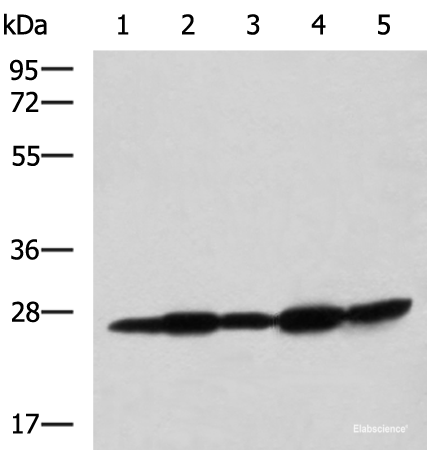 Western blot analysis of Mouse liver tissue Mouse brain tissue Rat brain tissue Rat liver tissue and Human fetal liver tissue lysates  using QDPR Polyclonal Antibody at dilution of 1:800