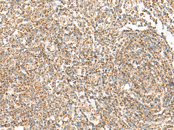 Immunohistochemistry of paraffin-embedded Human tonsil tissue  using ORC4 Polyclonal Antibody at dilution of 1:70(×200)