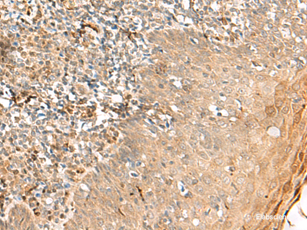 Immunohistochemistry of paraffin-embedded Human tonsil tissue  using ZNF397 Polyclonal Antibody at dilution of 1:45(×200)
