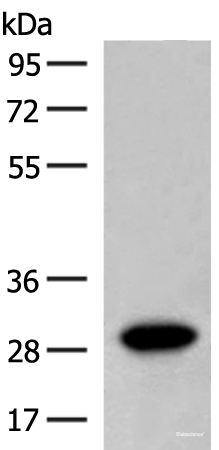 Western blot analysis of Human fetal brain tissue lysate  using SCGN Polyclonal Antibody at dilution of 1:600