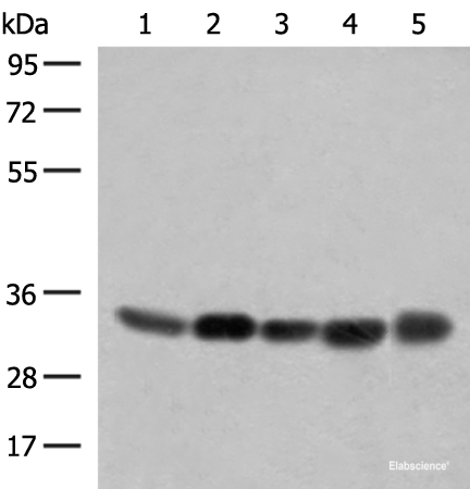 Western blot analysis of 231 PC-3 Hela A375 HepG2 cell lysates  using COPE Polyclonal Antibody at dilution of 1:350