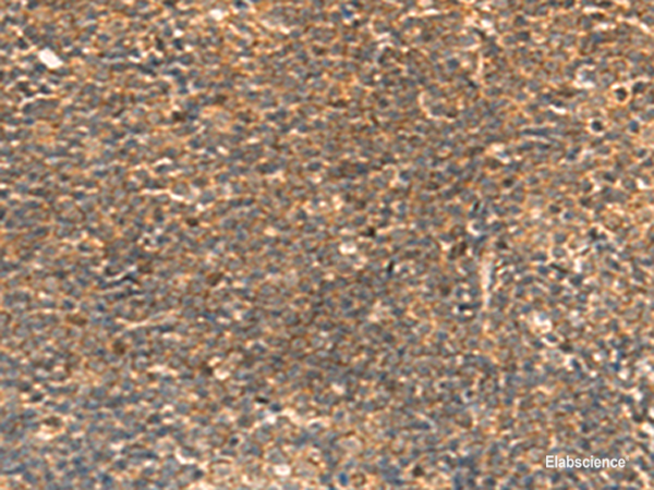 Immunohistochemistry of paraffin-embedded Human tonsil tissue  using STK32C Polyclonal Antibody at dilution of 1:30(×200)