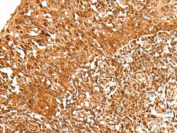 Immunohistochemistry of paraffin-embedded Human tonsil tissue  using ADRM1 Polyclonal Antibody at dilution of 1:30(×200)