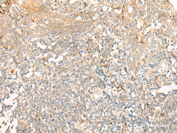 Immunohistochemistry of paraffin-embedded Human tonsil tissue  using GCAT Polyclonal Antibody at dilution of 1:60(×200)