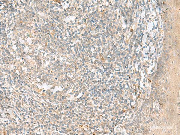 Immunohistochemistry of paraffin-embedded Human tonsil tissue  using TTLL1 Polyclonal Antibody at dilution of 1:90(×200)