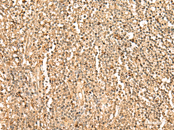 Immunohistochemistry of paraffin-embedded Human tonsil tissue  using PPM1G Polyclonal Antibody at dilution of 1:35(×200)