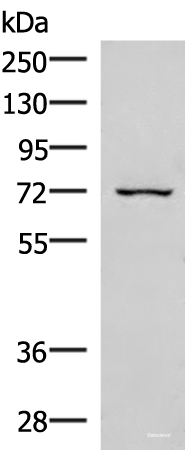 Western blot analysis of 293T cell lysate  using EIF2AK1 Polyclonal Antibody at dilution of 1:350