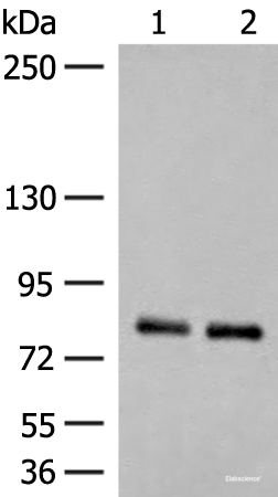 Western blot analysis of Rat brain tissue and Mouse brain tissue lysates  using NGEF Polyclonal Antibody at dilution of 1:250