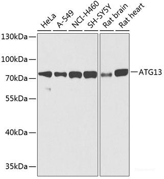 Immunohistochemistry of paraffin-embedded Human placenta using CLUH Polyclonal Antibody at dilution of  1:100 (40x lens).