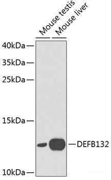 Immunohistochemistry of paraffin-embedded Human colon using c-Jun Polyclonal Antibody at dilution of  1:100 (40x lens).