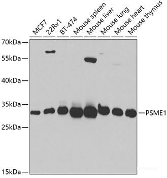 Immunohistochemistry of paraffin-embedded Human liver damage using PSMF1 Polyclonal Antibody at dilution of  1:100 (40x lens).