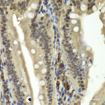 Immunohistochemistry of paraffin-embedded Human kidney using ACTL6B Polyclonal Antibody at dilution of  1:100 (40x lens).