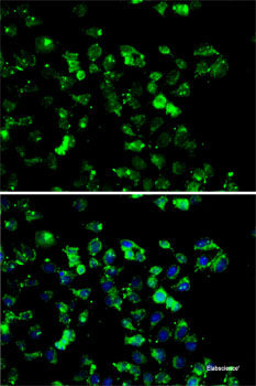 Western blot analysis of extracts of various cell lines using ANAPC5 Polyclonal Antibody at dilution of 1:1000.