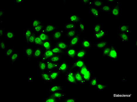 Immunohistochemistry of paraffin-embedded Human colon carcinoma using MTFP1 Polyclonal Antibody at dilution of  1:100 (40x lens).