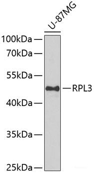 Immunofluorescence analysis of A549 cells using DPP8 Polyclonal Antibody