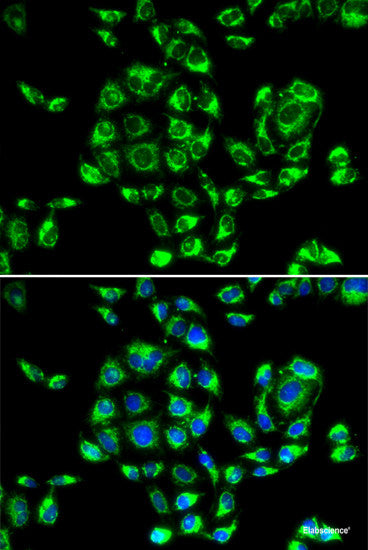 Immunofluorescence analysis of A-549 cells using EAF2 Polyclonal Antibody