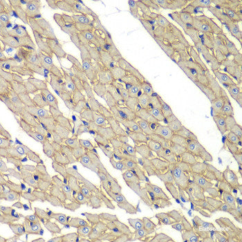 Immunofluorescence analysis of A549 cells using SALL4 Polyclonal Antibody
