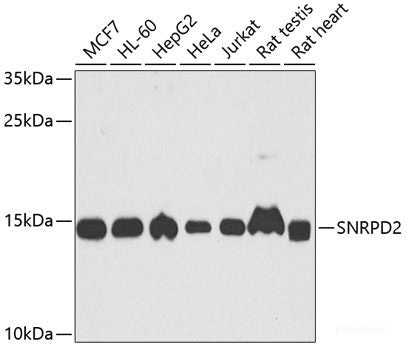 Immunohistochemistry of paraffin-embedded Rat kidney using CSRNP1 Polyclonal Antibody at dilution of  1:200 (40x lens).