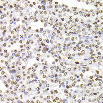Immunofluorescence analysis of U2OS cells using MARCKSL1 Polyclonal Antibody