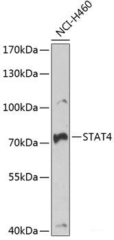 Immunohistochemistry of paraffin-embedded Mouse lung using ALKBH8 Polyclonal Antibody at dilution of  1:100 (40x lens).
