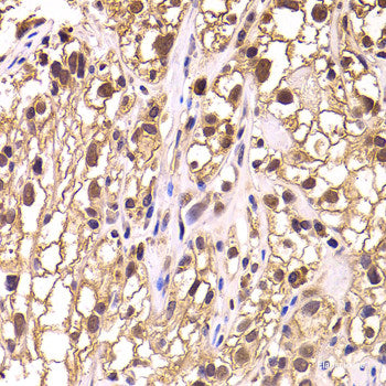 Immunofluorescence analysis of L929 cells using COMMD1 Polyclonal Antibody at dilution of  1:100. Blue: DAPI for nuclear staining.