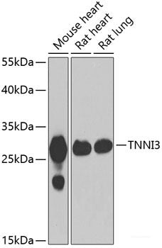 Immunofluorescence analysis of A-549 cells using U2AF1L4 Polyclonal Antibody