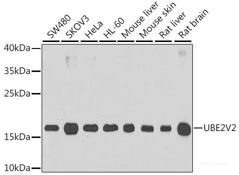 Western blot analysis of extracts of Rat liver using NCR3 Polyclonal Antibody at dilution of 1:1000.