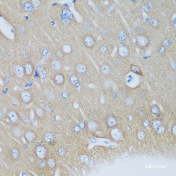 Immunofluorescence analysis of A549 cells using BCL2L15 Polyclonal Antibody
