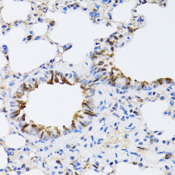 Immunohistochemistry of paraffin-embedded Mouse kidney using CNPY3 Polyclonal Antibody at dilution of  1:100 (40x lens).