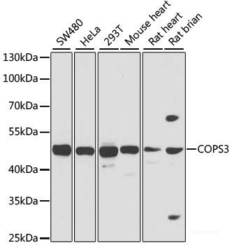 Immunohistochemistry of paraffin-embedded Rat brain using EPHA2 Polyclonal Antibody at dilution of  1:100 (40x lens).