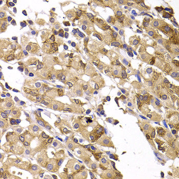 Immunofluorescence analysis of A549 cells using GTF2H3 Polyclonal Antibody