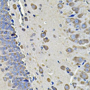 Immunofluorescence analysis of A549 cells using HDAC5 Polyclonal Antibody