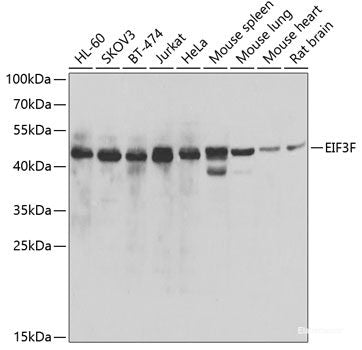 Immunohistochemistry of paraffin-embedded Human colon carcinoma using IDH2 Polyclonal Antibody at dilution of  1:100 (40x lens).