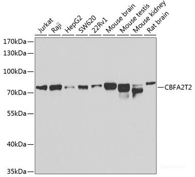 Immunohistochemistry of paraffin-embedded Rat kidney using NAT8B Polyclonal Antibody at dilution of  1:200 (40x lens).