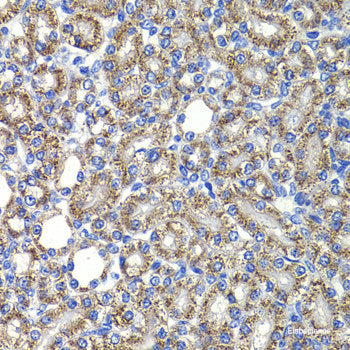 Immunofluorescence analysis of A-549 cells using PHYHD1 Polyclonal Antibody