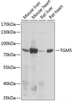 Immunohistochemistry of paraffin-embedded Rat lung using RSRC1 Polyclonal Antibody at dilution of  1:100 (40x lens).