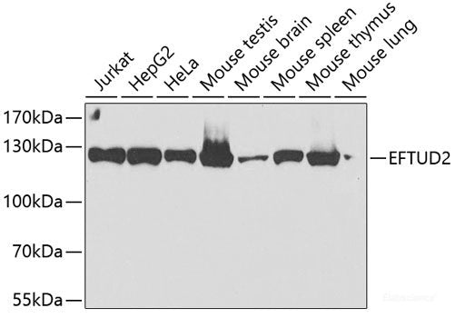 Immunofluorescence analysis of A-549 cells using SAT2 Polyclonal Antibody