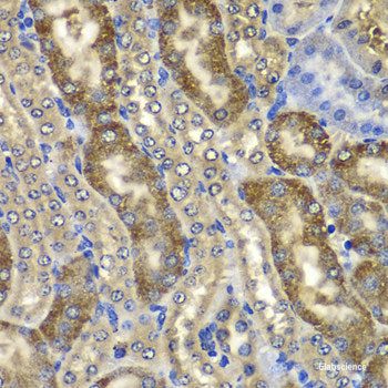 Immunofluorescence analysis of A-549 cells using SETBP1 Polyclonal Antibody
