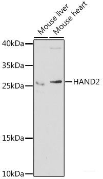 Immunofluorescence analysis of MCF-7 cells using SNRPD1 Polyclonal Antibody