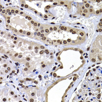 Immunofluorescence analysis of MCF-7 cells using SYCE1 Polyclonal Antibody