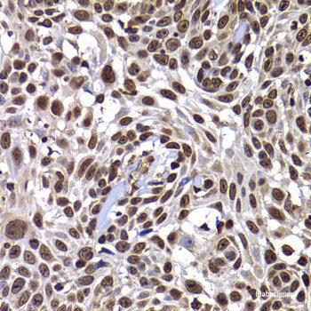 Immunohistochemistry of paraffin-embedded Human liver damage using TOB2 Polyclonal Antibody at dilution of  1:100 (40x lens).