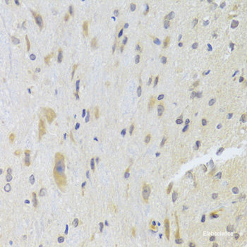 Immunohistochemistry of paraffin-embedded Human kidney using UBE2Z Polyclonal Antibody at dilution of  1:100 (40x lens).