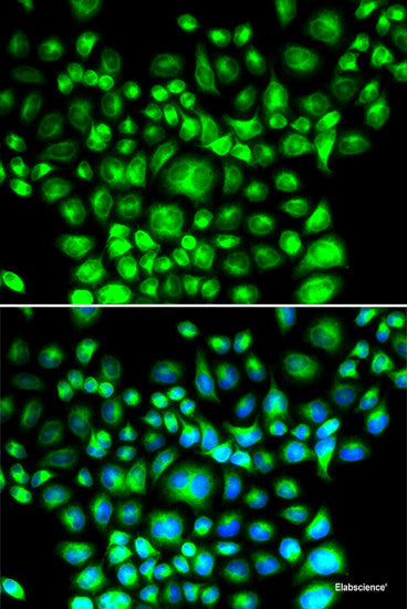 Immunofluorescence analysis of HeLa cells using SLC35A2 Polyclonal Antibody