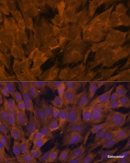 Western blot analysis of extracts of various cell lines using ITLN1 Polyclonal Antibody at dilution of 1:1000.