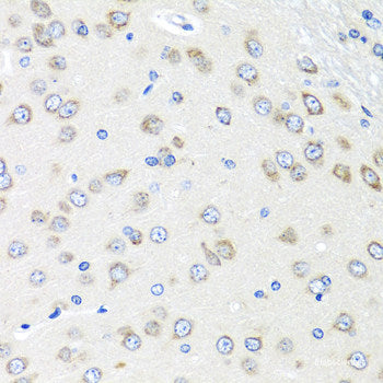 Immunohistochemistry of paraffin-embedded Rat testis using DNMT3B Polyclonal Antibody at dilution of  1:100 (40x lens).