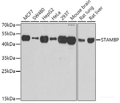 Western blot analysis of extracts of various cell lines using Acetyl-Histone H3-K27 Polyclonal Antibody at dilution of 1:1000.